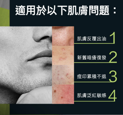 曼秀雷敦 草本控油潔面乳 150ml